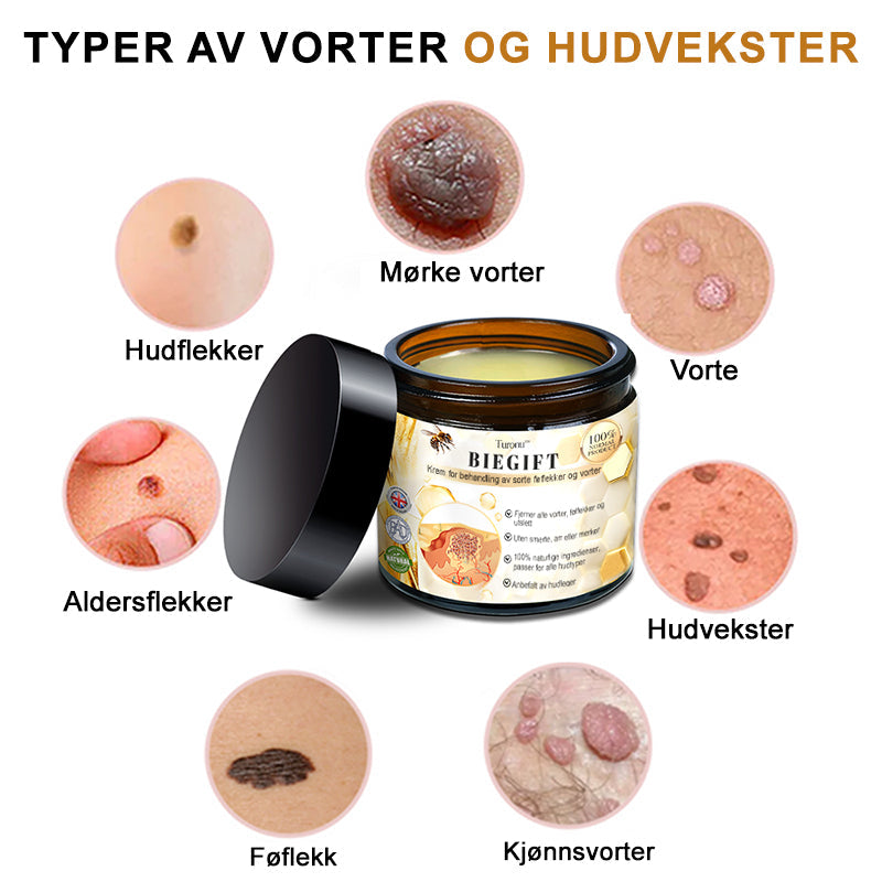 🦍Turoment™ Bie Gift Behandlingskrem (🔥Siste dag, 80 % rabatt)