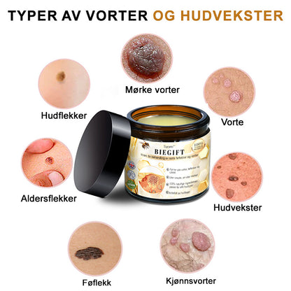 🦍Turoment™ Bie Gift Behandlingskrem (🔥Siste dag, 80 % rabatt)