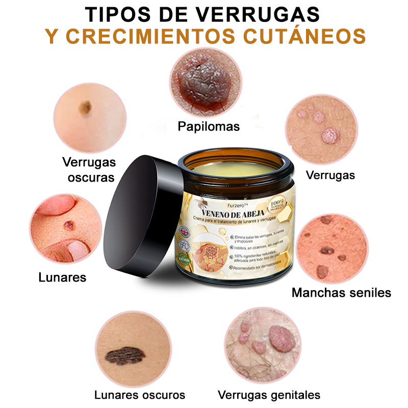 🎏Turonu™ Crema de Tratamiento con Veneno de Abeja (🔥Último día, 80 % de descuento)