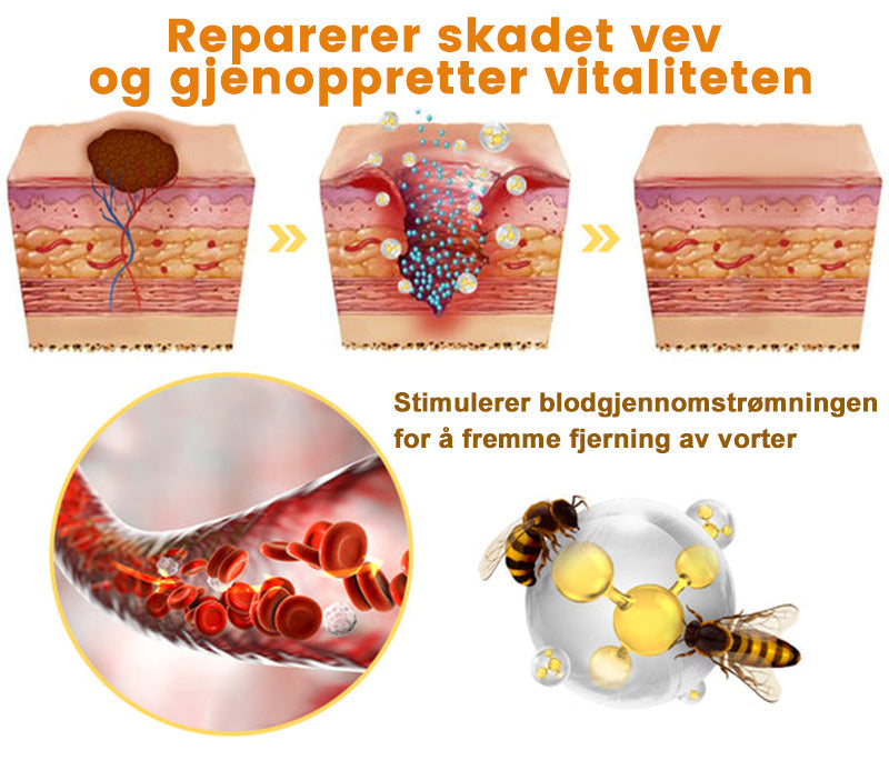 🐅Turoment™ Bie Gift Behandlingskrem (🔥Siste dag, 80 % rabatt)