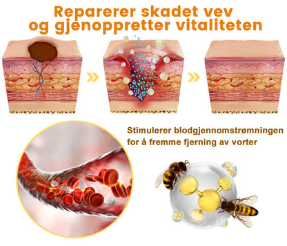 🦓Turoment™ Bie Gift Behandlingskrem (🔥Siste dag, 80 % rabatt)
