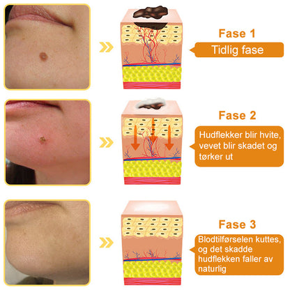 🐆Turoment™ Bie Gift Behandlingskrem (🔥Siste dag, 80 % rabatt)
