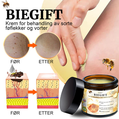 🐆Turoment™ Bie Gift Behandlingskrem (🔥Siste dag, 80 % rabatt)