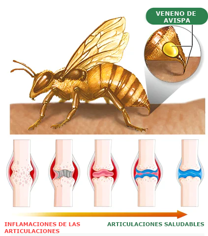 👔Furzero™ Crema de Veneno de Abeja para Articulaciones y Huesos (✨ Especialmente para condiciones ortopédicas y dolor articular ✨)