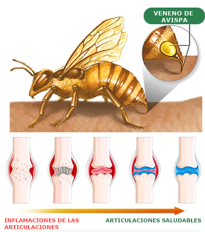 👔Furzero™ Crema de Veneno de Abeja para Articulaciones y Huesos (✨ Especialmente para condiciones ortopédicas y dolor articular ✨)