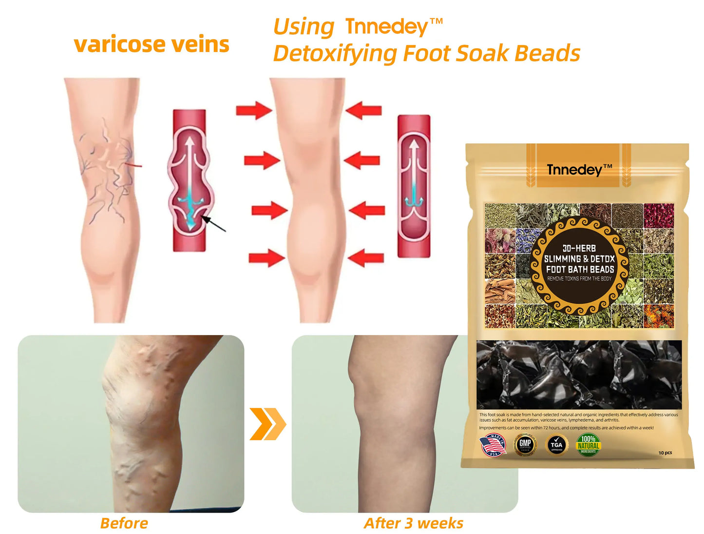 GFOUK™ 30-Hierbas Para Adelgazamiento y Desintoxicación - Perlas para Baño de Pies - 💓👩‍⚕️
