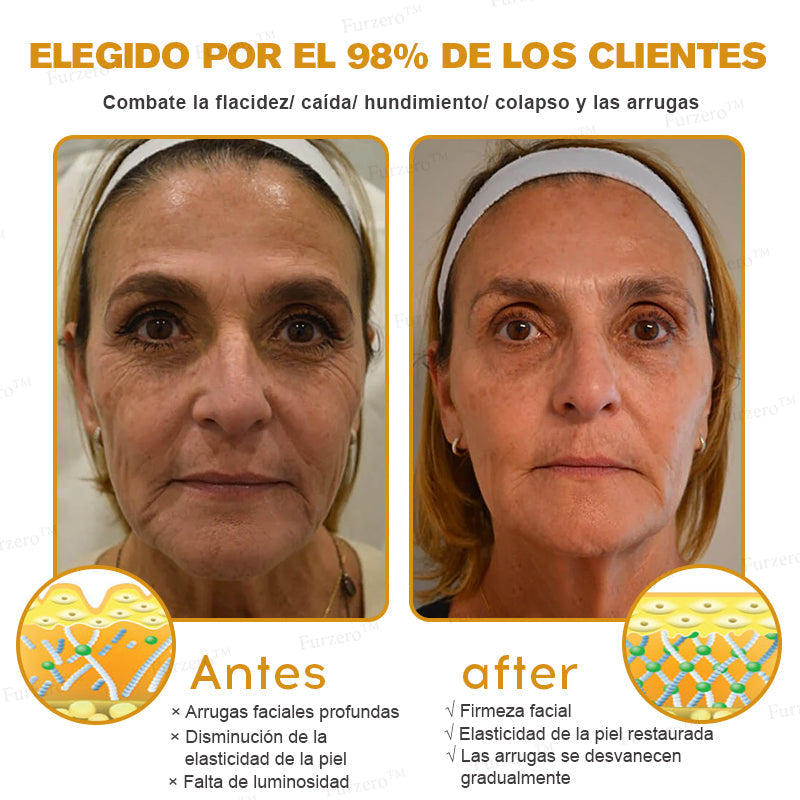💎🍀Fabricado y enviado desde España ✅Furzero™ Botox & Veneno de Abeja – Crema Lifting Antiarrugas-Promoción de último día 70% de descuento
