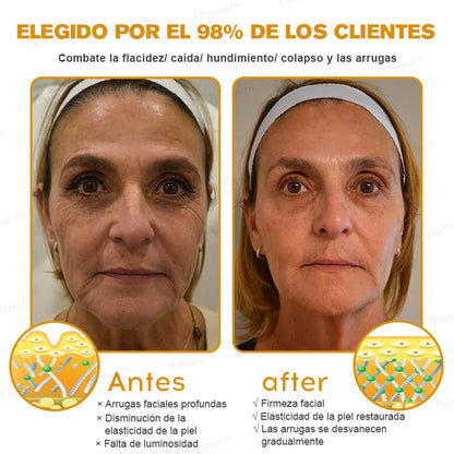 💎🍀Fabricado y enviado desde España ✅Furzero™ Botox & Veneno de Abeja – Crema Lifting Antiarrugas-Promoción de último día 70% de descuento