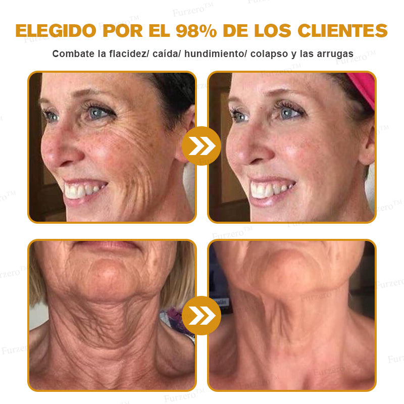 💎🍀Fabricado y enviado desde España ✅Furzero™ Botox & Veneno de Abeja – Crema Lifting Antiarrugas-Promoción de último día 70% de descuento