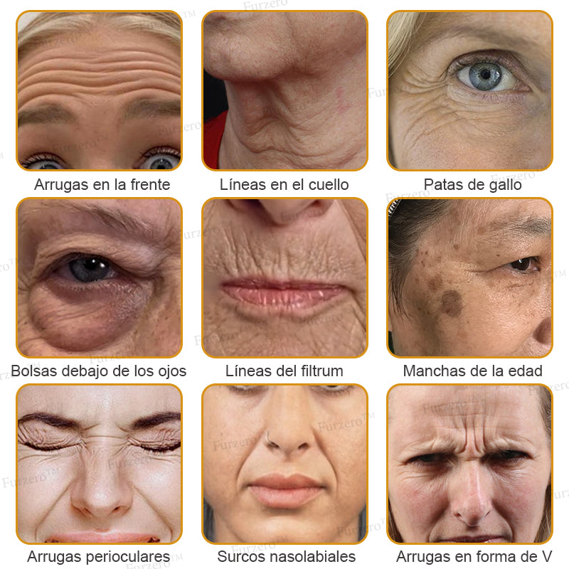 💎🍀Fabricado y enviado desde España ✅Furzero™ Botox & Veneno de Abeja – Crema Lifting Antiarrugas-Promoción de último día 70% de descuento