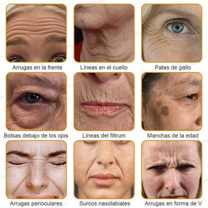 💎🍀Fabricado y enviado desde España ✅Furzero™ Botox & Veneno de Abeja – Crema Lifting Antiarrugas-Promoción de último día 70% de descuento