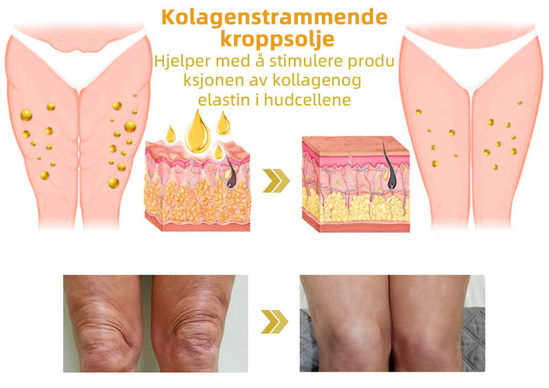 🐶Fubsta® Avansert Oppstrammende og Rynkereduserende Krem: Gjenopprett Hudens Elastisitet