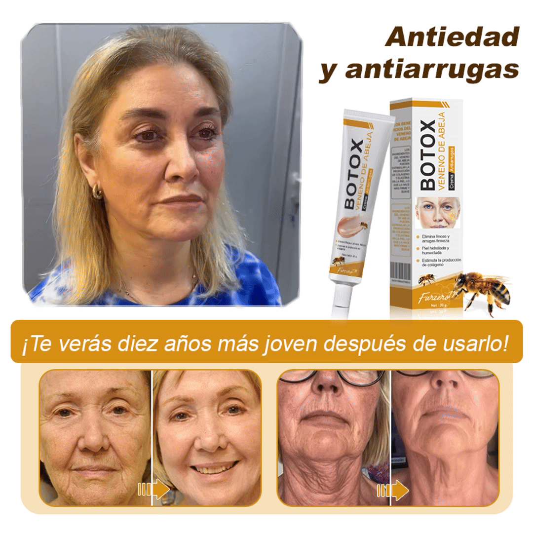 💎🍀Fabricado y enviado desde España ✅Furzero™ Botox & Veneno de Abeja – Crema Lifting Antiarrugas-Promoción de último día 70% de descuento