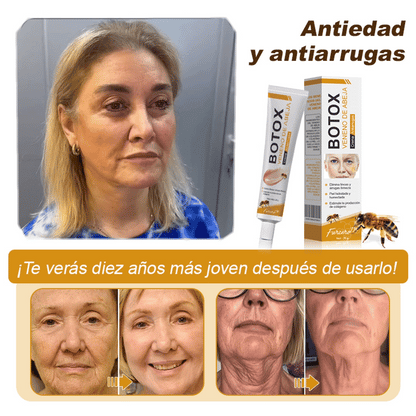 💎🍀Fabricado y enviado desde España ✅Furzero™ Botox & Veneno de Abeja – Crema Lifting Antiarrugas-Promoción de último día 70% de descuento