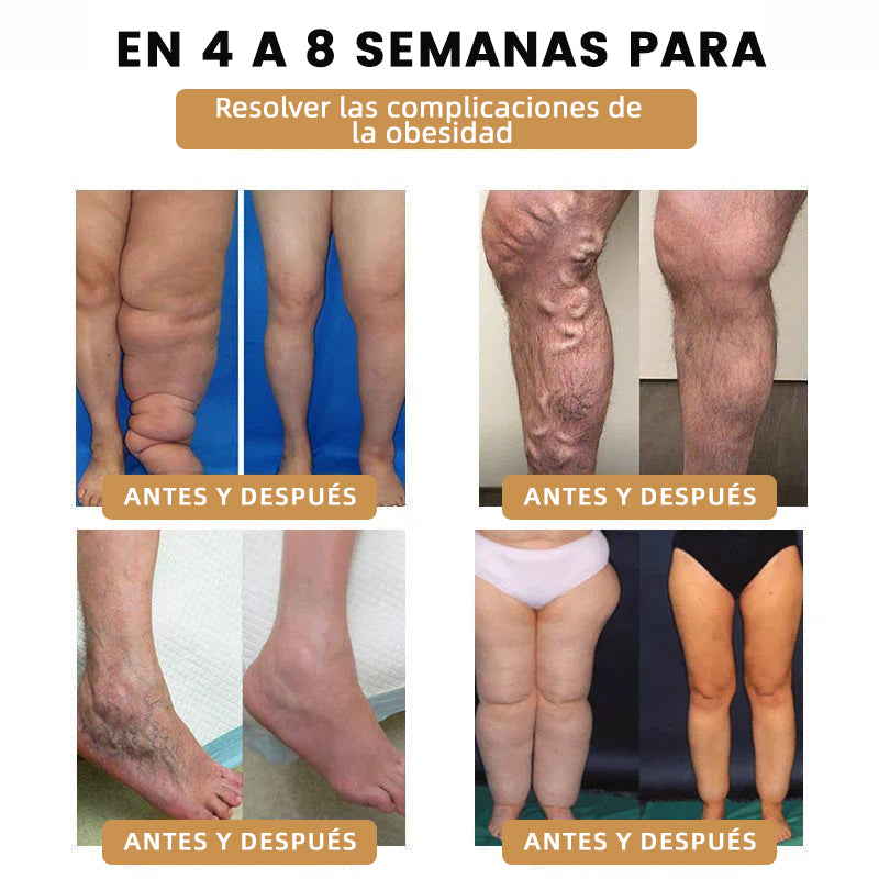 2024 🆕FutuslyL™ Pulsera Ultrasonica de Eliminación de Grasa y Desintoxicación - Balance de Energía ⏱️ (Último día con 80% de descuento + Recomendado por médicos) ⌚⌚