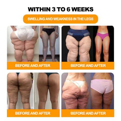 GFOUK™ 30-Hierbas Para Adelgazamiento y Desintoxicación - Perlas para Baño de Pies - 💓👩‍⚕️