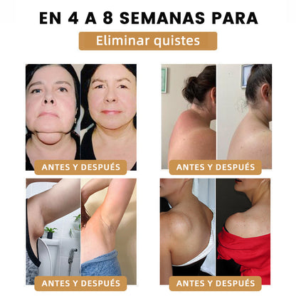 2024 🆕FutuslyL™ Pulsera Ultrasonica de Eliminación de Grasa y Desintoxicación - Balance de Energía ⏱️ (Último día con 80% de descuento + Recomendado por médicos) ⌚⌚