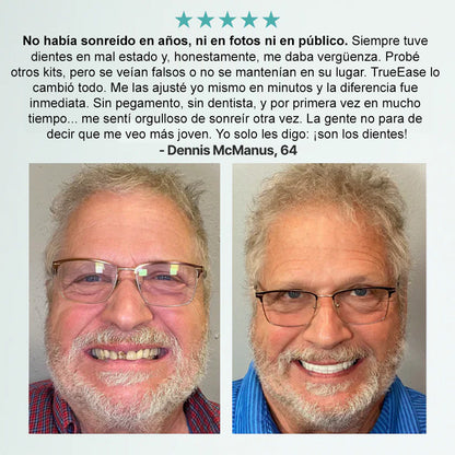 🦷Bikenda® Conjunto Completo de Dentaduras Personalizadas Avanzadas (✅ Dentaduras de ajuste cómodo respaldadas clínicamente — Confiadas por más de 8,000 usuarios en España para un confort durante todo el día.)