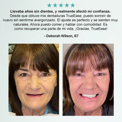 🦷Bikenda® Conjunto Completo de Dentaduras Personalizadas Avanzadas (✅ Dentaduras de ajuste cómodo respaldadas clínicamente — Confiadas por más de 8,000 usuarios en España para un confort durante todo el día.)