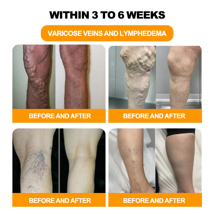 GFOUK™ 30-Hierbas Para Adelgazamiento y Desintoxicación - Perlas para Baño de Pies - 💓👩‍⚕️