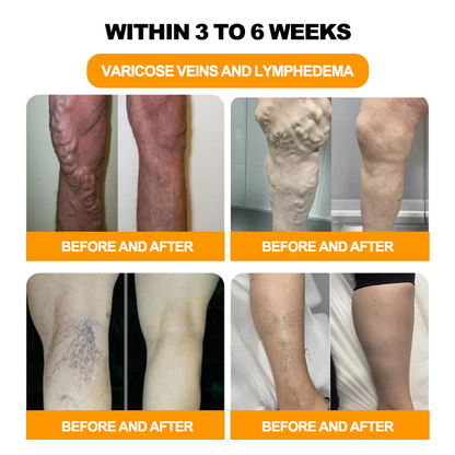GFOUK™ 30-Hierbas Para Adelgazamiento y Desintoxicación - Perlas para Baño de Pies - 💓👩‍⚕️
