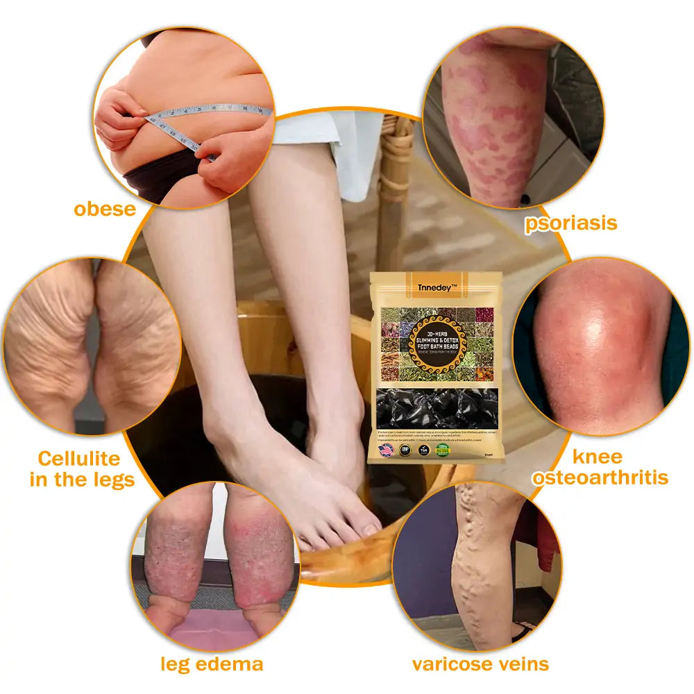 GFOUK™ 30-Hierbas Para Adelgazamiento y Desintoxicación - Perlas para Baño de Pies - 💓👩‍⚕️